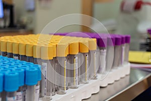 View of empty test tubes ÃÂ  photo